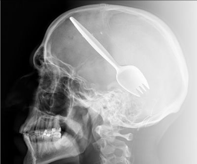 skull xray with plastic spoon inside